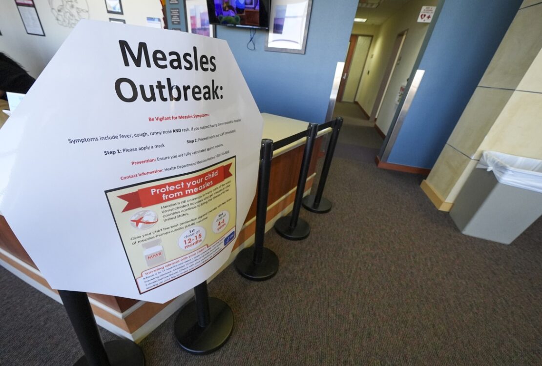 Second child dies from measles-related causes in West Texas, where cases near 500 : NPR