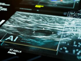 FDA approves first AI tool to predict breast cancer risk